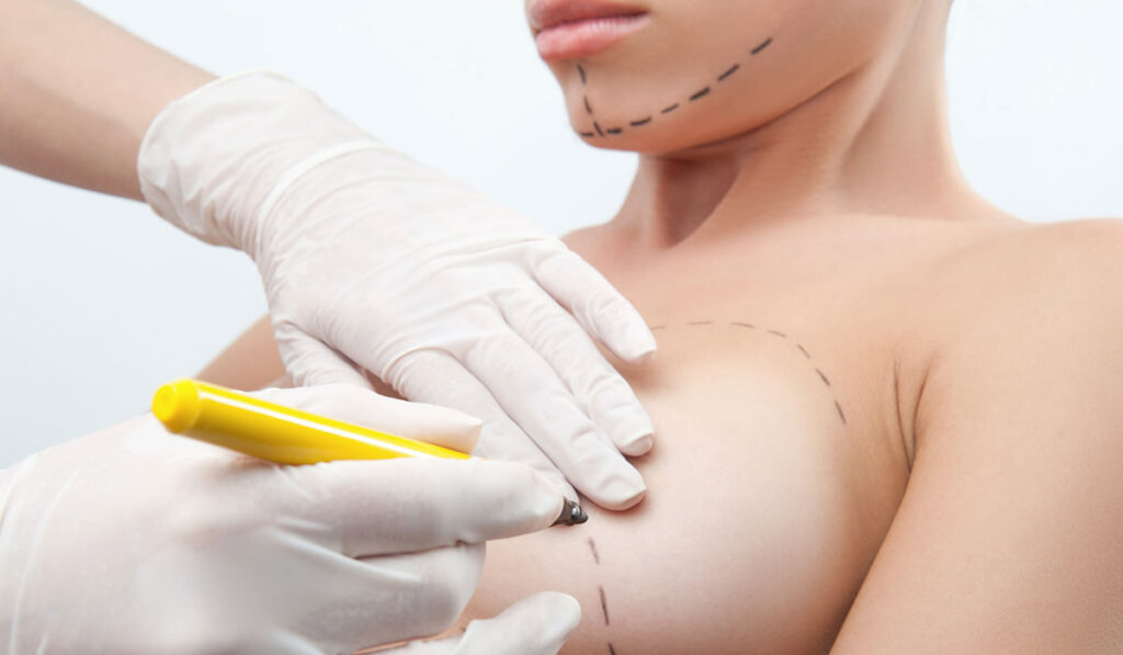 حقن الدهون الذاتية للصدر