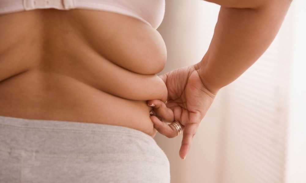 عملية شفط دهون الظهر