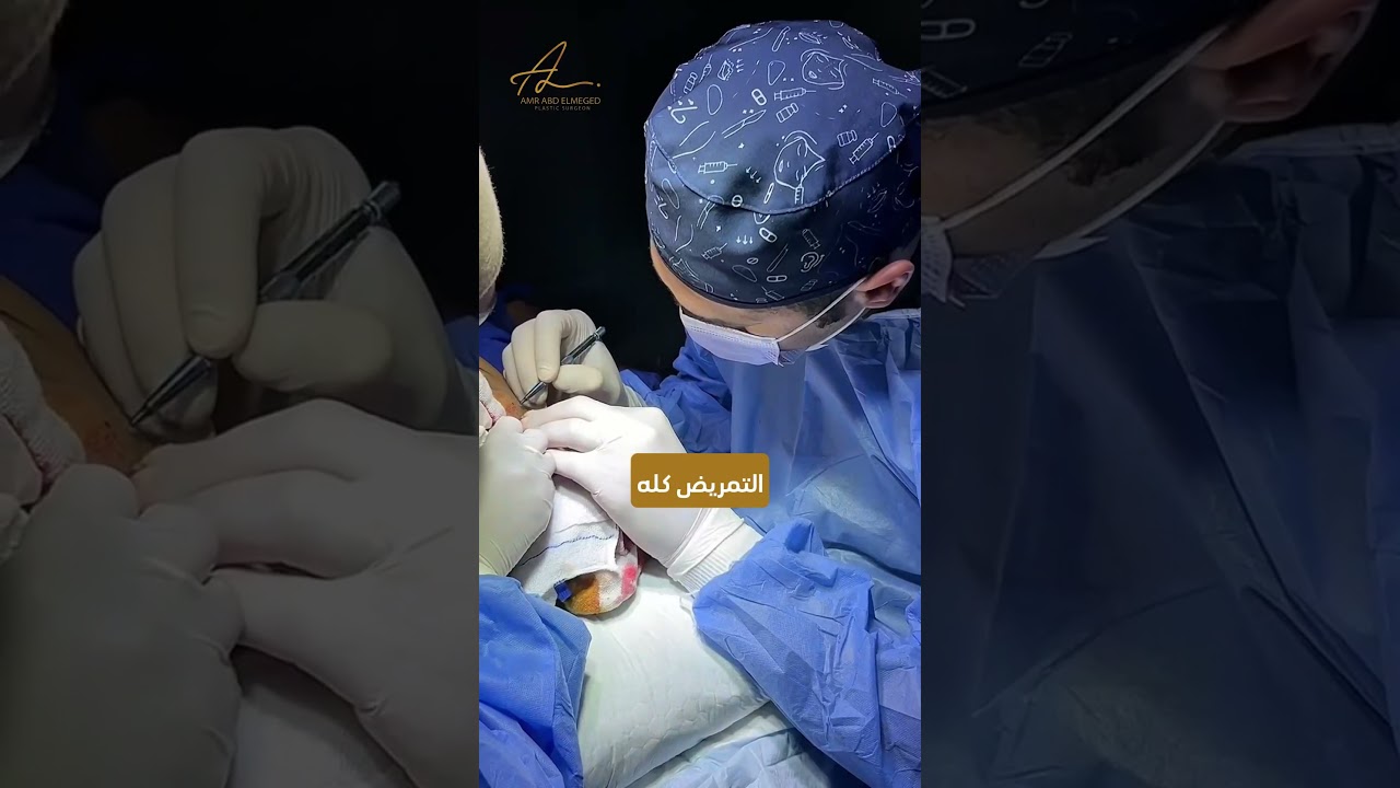 تجربة زراعة شعر مع دكتور عمرو عبد المجيد