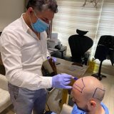 دكتور علاء حجاج زراعة شعر