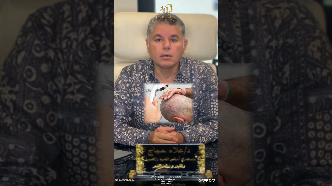 علاج الحكة بعد زراعة الشعر مع دكتور علاء حجاج